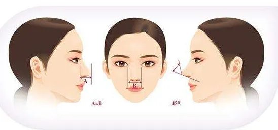 做假体隆鼻大概需要多少钱？