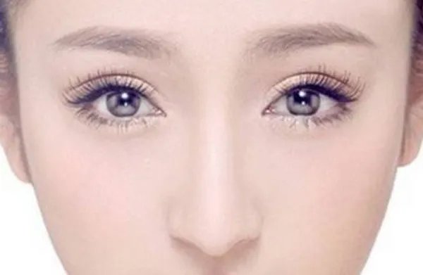 上海有没有开眼角好的医院