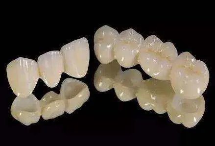 钛合金烤瓷牙的危害