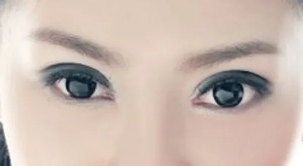 上海有没有开眼角好的医院