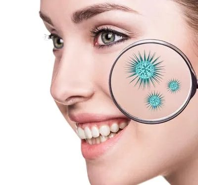 怎样把青春痘去除呢