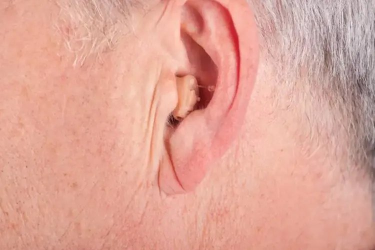 耳垂有一道深横线图片