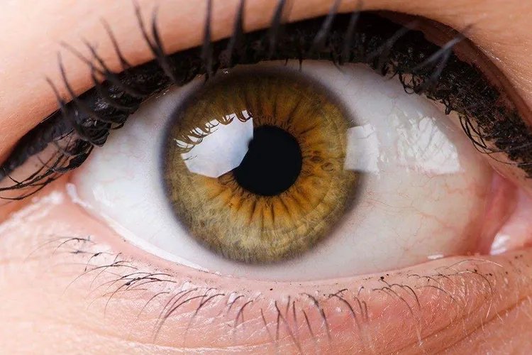 瞳孔散大图片和正常的对比